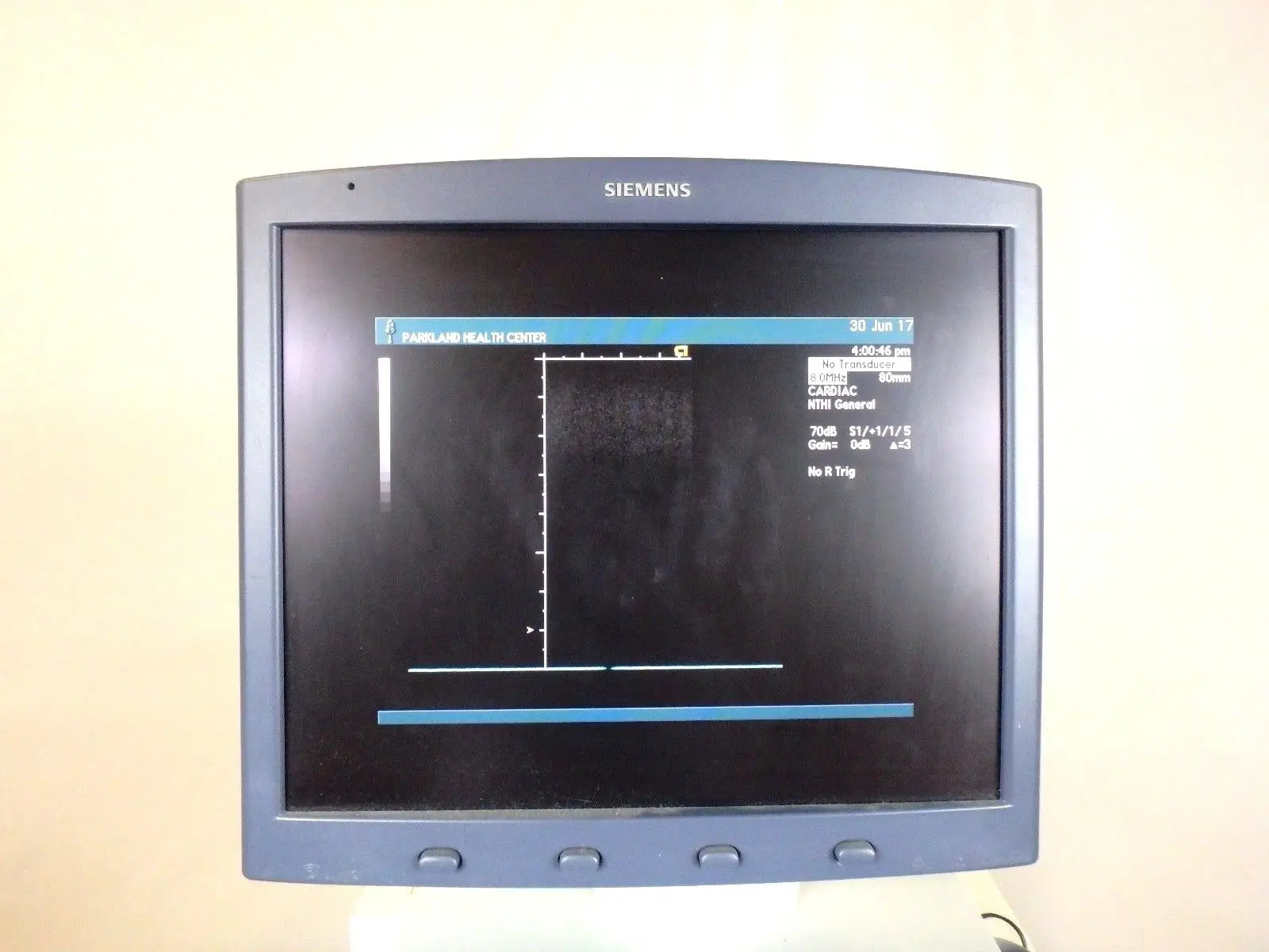 Siemens Acuson Sequoia 512 Ultrasound System w/ 2 Probe 8L5 15L8 & ECG EKG Cable DIAGNOSTIC ULTRASOUND MACHINES FOR SALE