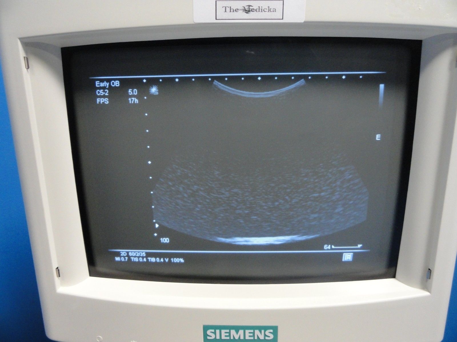 2004 Siemens C5-2 CONVEX ARRAY Ultrasound Probe for Sonoline G20 (11477) DIAGNOSTIC ULTRASOUND MACHINES FOR SALE