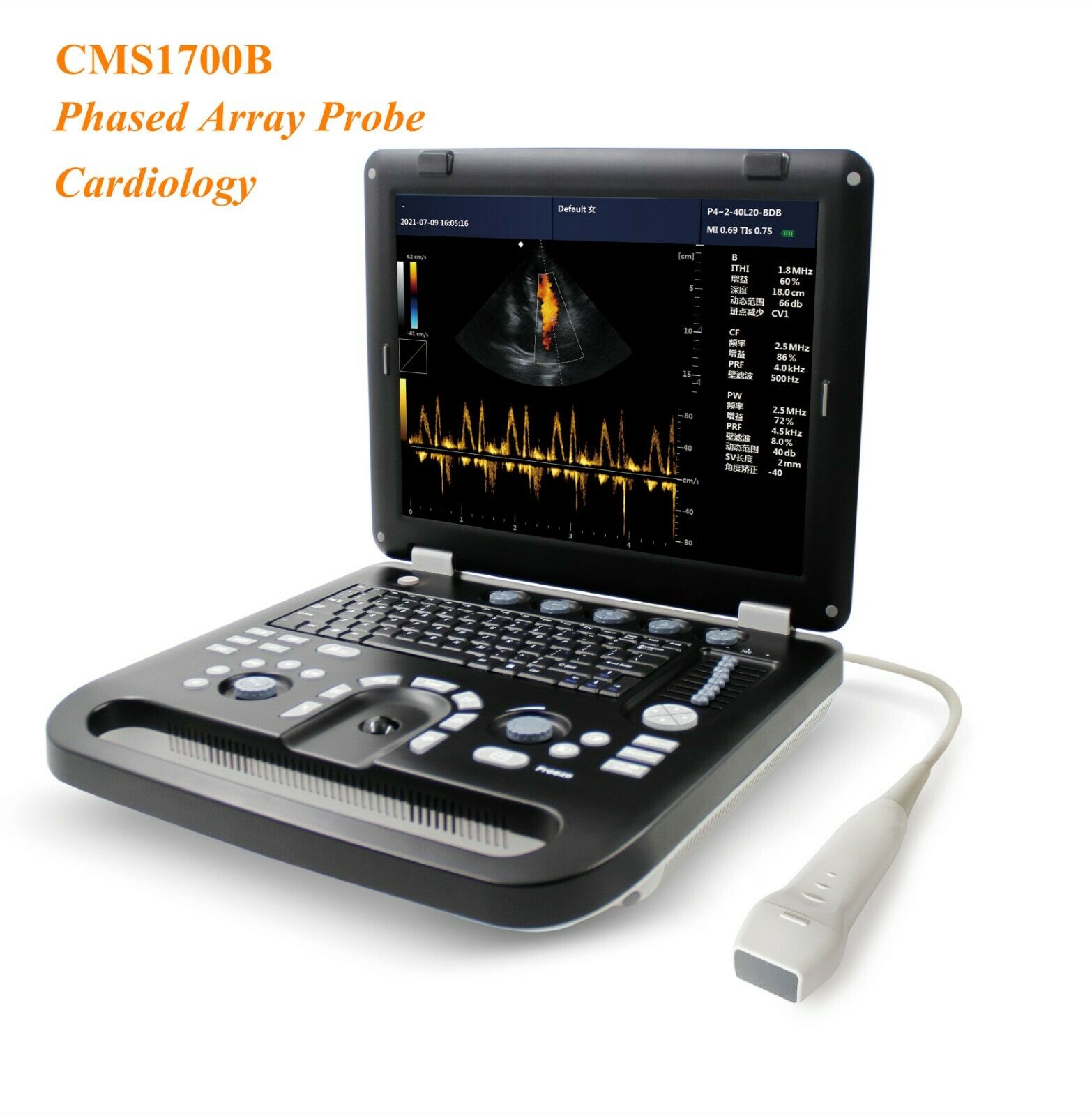 Portable Cardiac Heart Ultrasound Scanner Color Doppler Machine Phased Array PW DIAGNOSTIC ULTRASOUND MACHINES FOR SALE