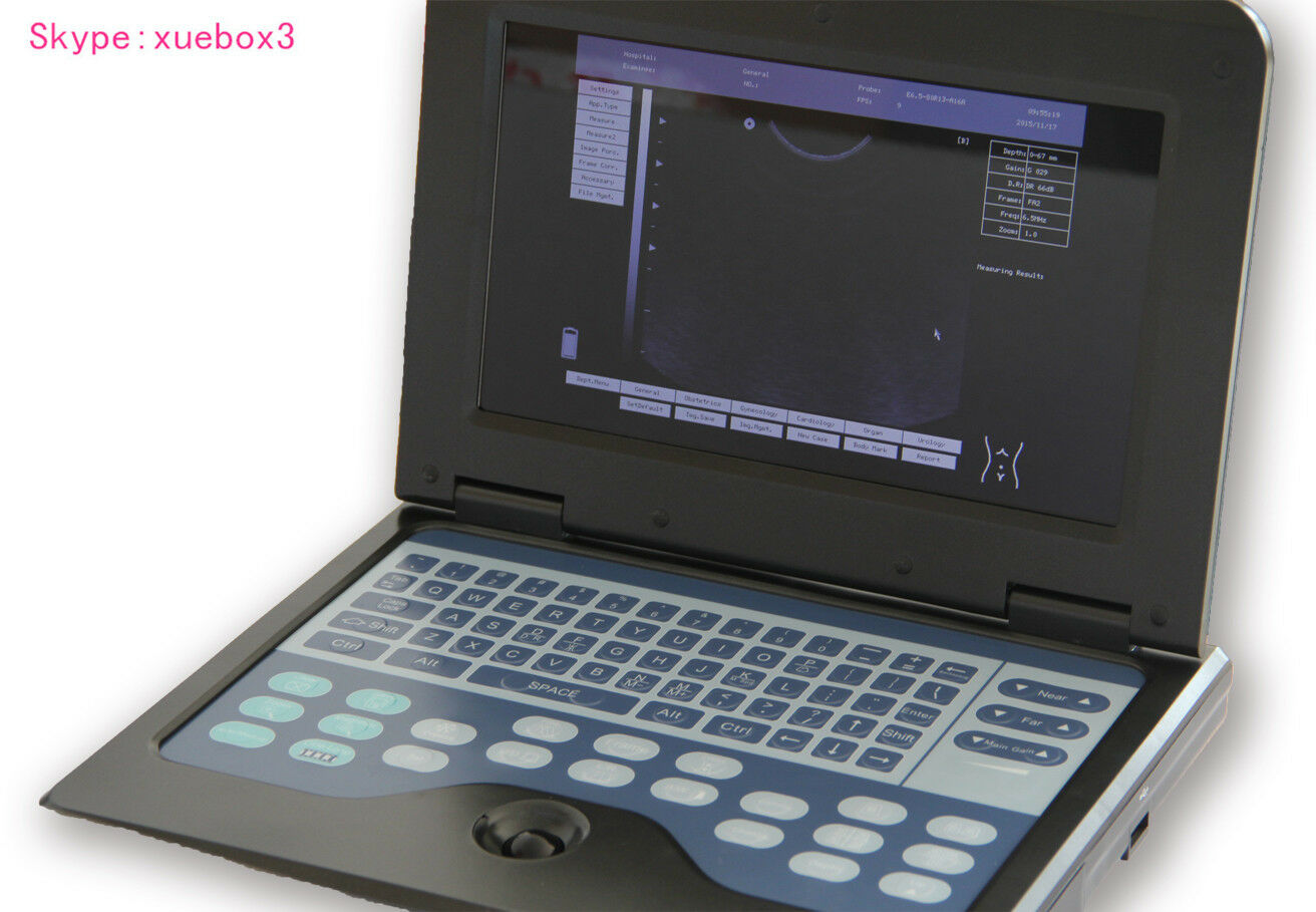 US-Digital-Portable-Ultrasound-Scanner-Machine+Cardiac+Convex Two probes  Sale. DIAGNOSTIC ULTRASOUND MACHINES FOR SALE