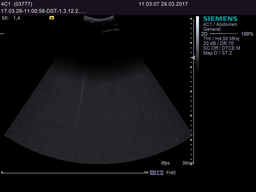 Ultrasound probe SIEMENS Acuson 4C1 DIAGNOSTIC ULTRASOUND MACHINES FOR SALE