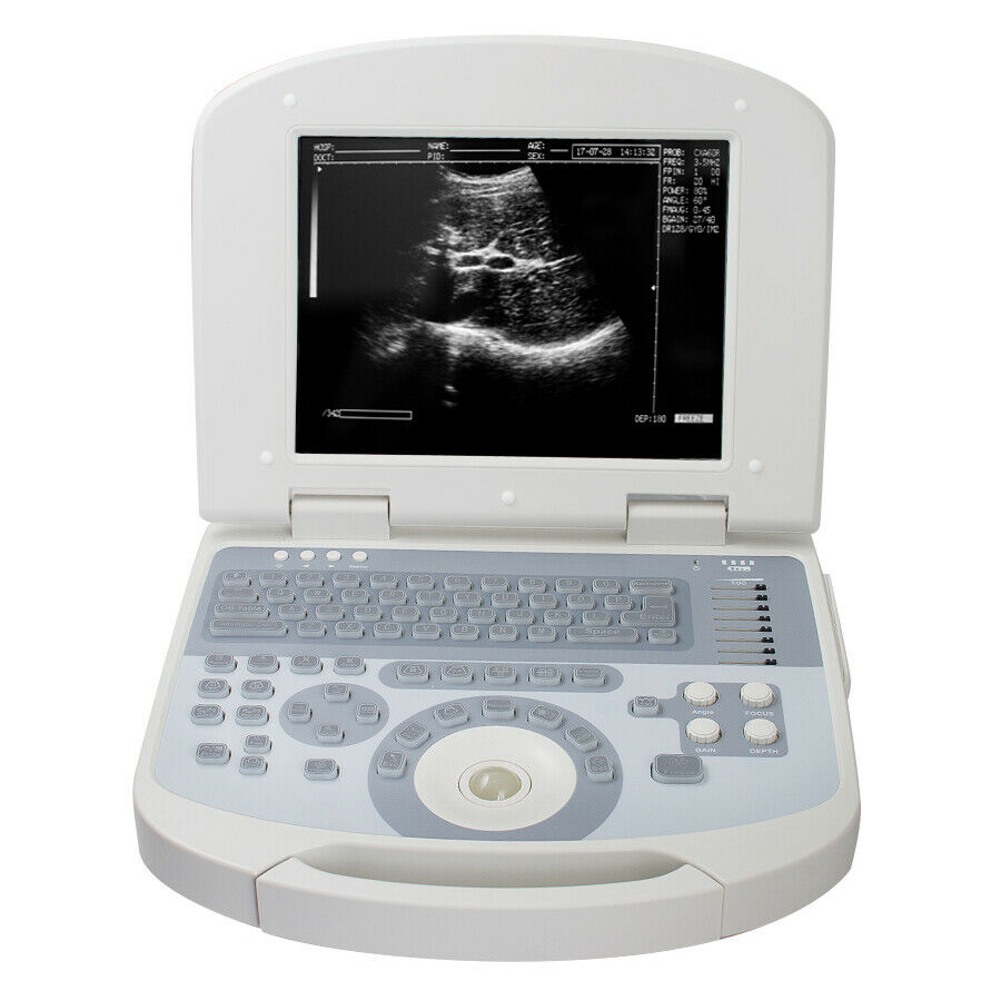 USA 10.4 inch Digital Laptop Medical Ultrasound Scanner 3.5MHZ Convex Probe USA DIAGNOSTIC ULTRASOUND MACHINES FOR SALE