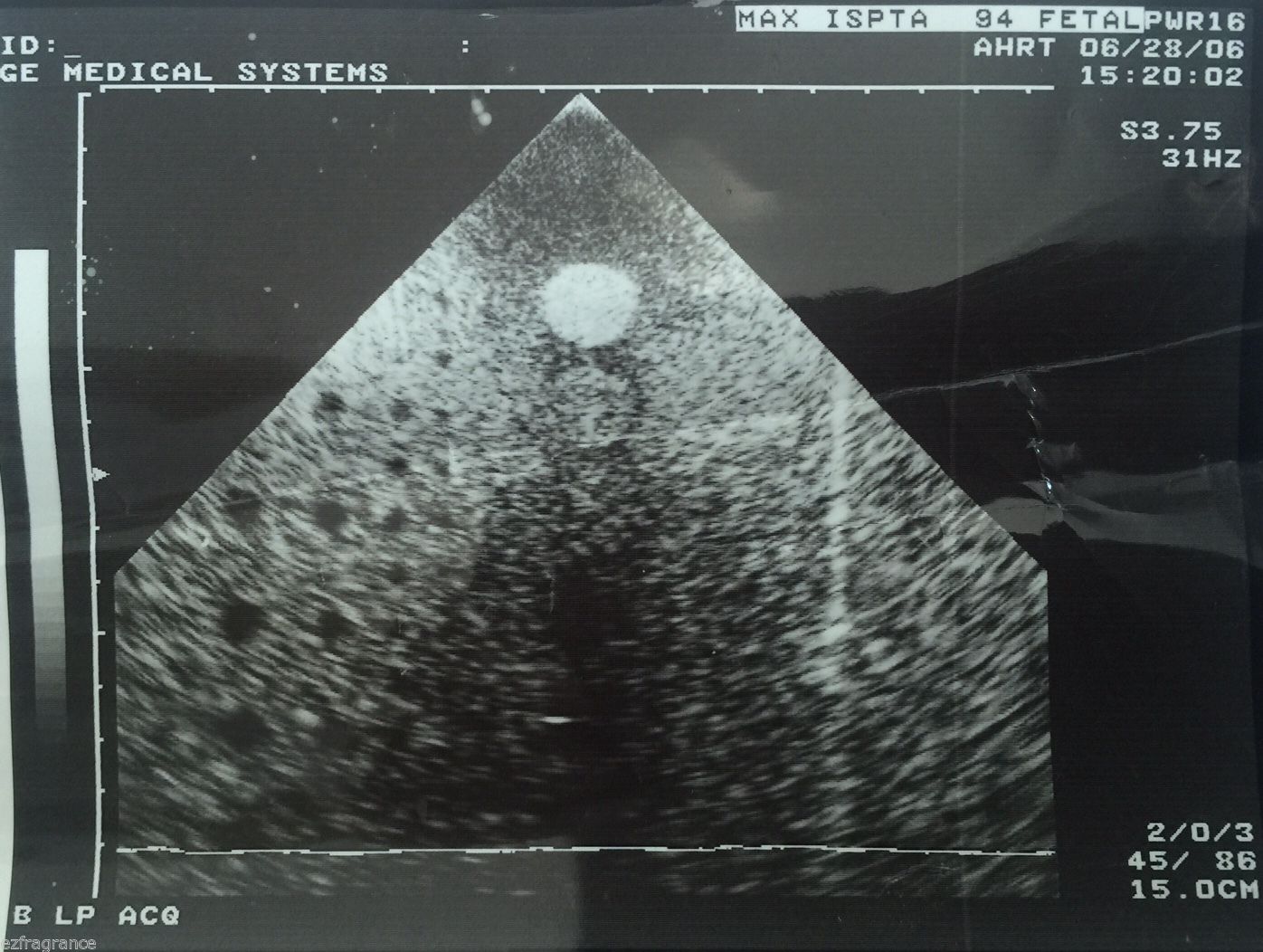 TOSHIBA PSF-37HT 3.75MHz Phased Array Ultrasound Transducer ~ USED DIAGNOSTIC ULTRASOUND MACHINES FOR SALE