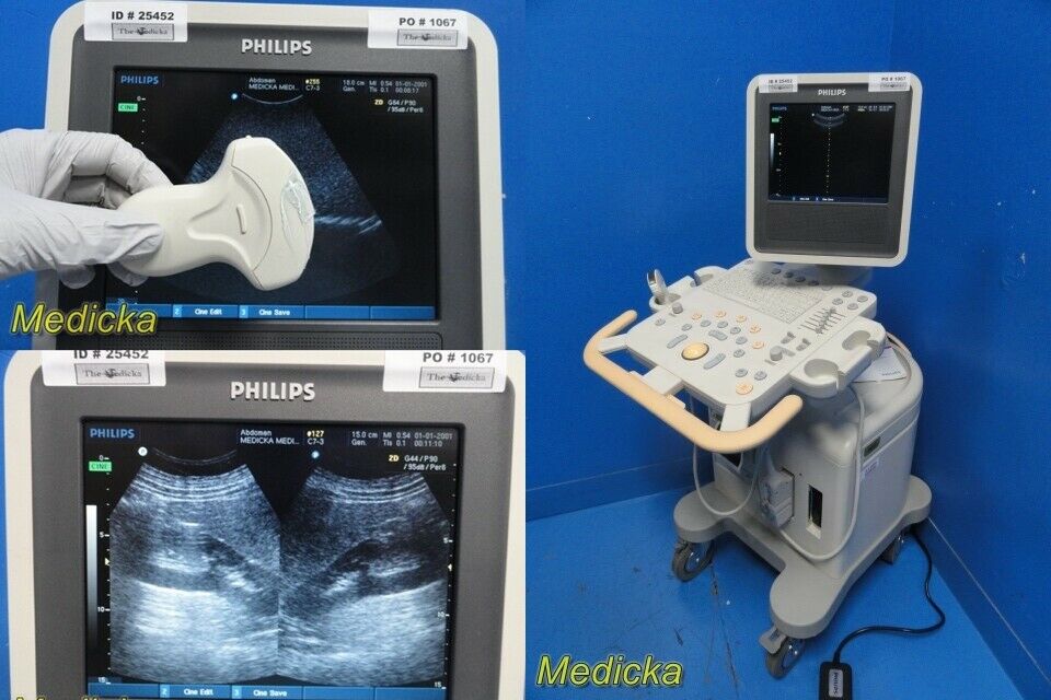 Philips HD3(HD3-Exp) Ultrasound System W/ C7-3 Convex Probe, Printer & PSU~25452 DIAGNOSTIC ULTRASOUND MACHINES FOR SALE