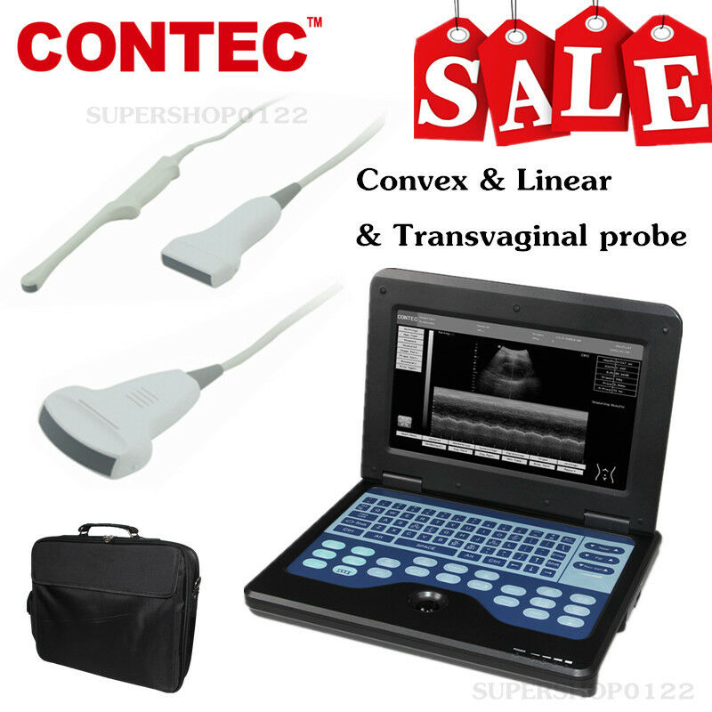 Digital Portable Laptop Ultrasound Scanner+convex+linear+transvaginal 3 probes DIAGNOSTIC ULTRASOUND MACHINES FOR SALE