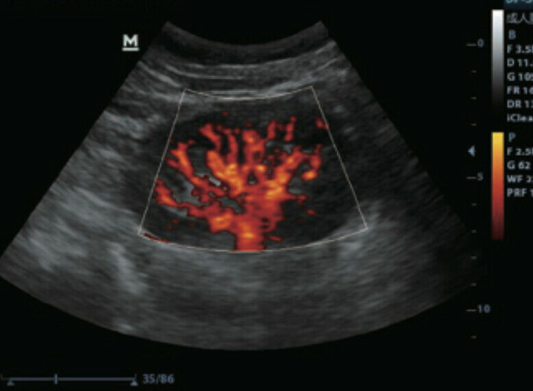 Most Affordable Vet Color Doppler Ultrasound W/ Three Probes, LED,THI, PW DIAGNOSTIC ULTRASOUND MACHINES FOR SALE