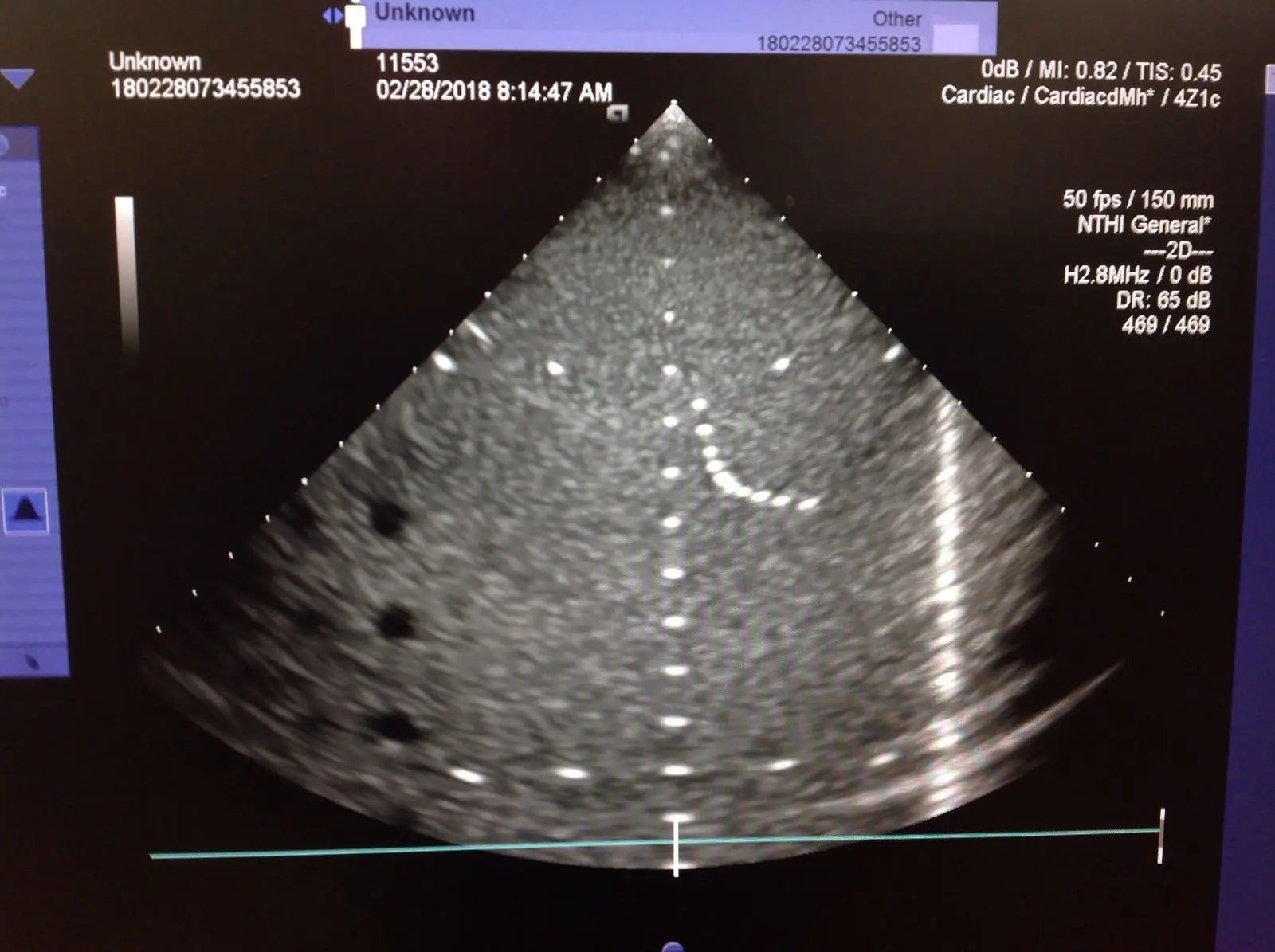 Siemens 4Z1C Ultrasound Probe DIAGNOSTIC ULTRASOUND MACHINES FOR SALE