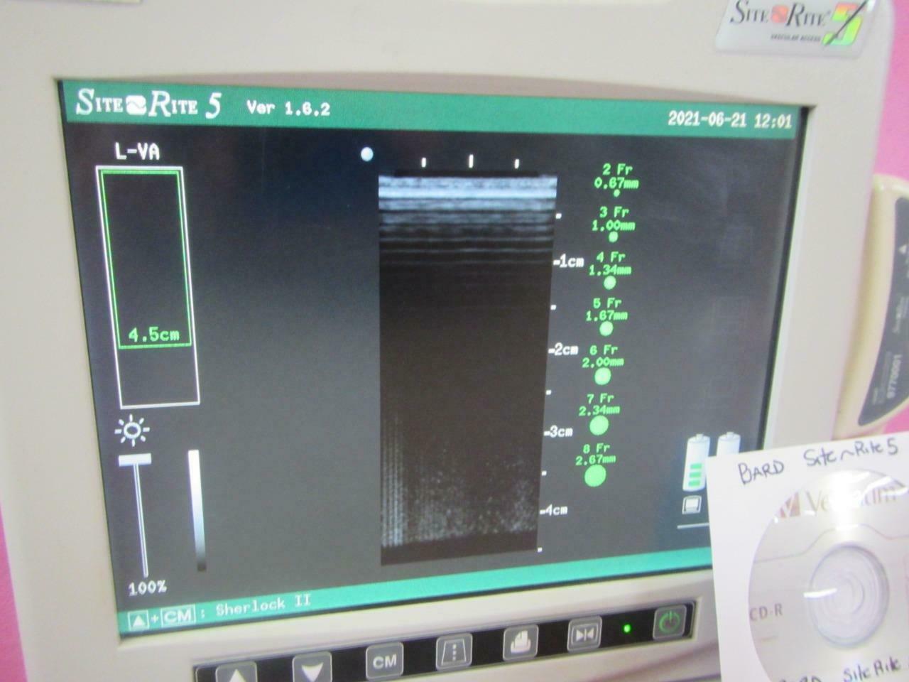 Bard Site Rite 5 Ultrasound Machine, Vascular Access Probe, Sherlock 2 Software DIAGNOSTIC ULTRASOUND MACHINES FOR SALE