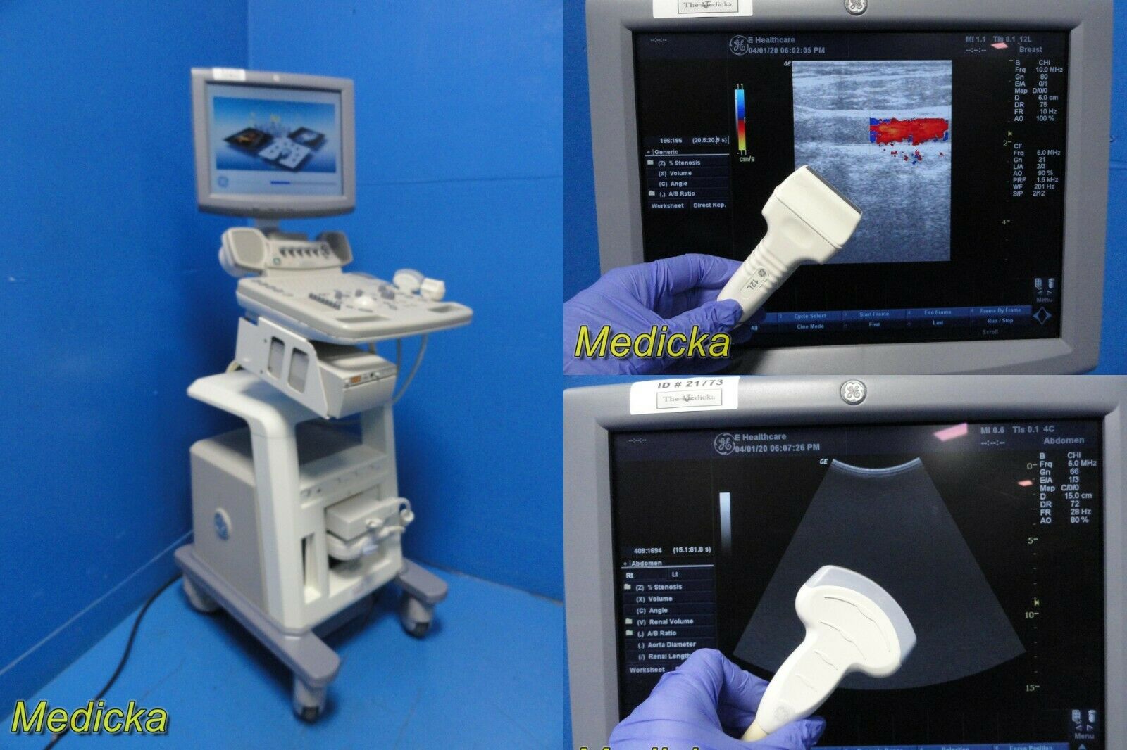 2008 GE LogiQ P5 Flat-Screen Ultrasound W/ 4C & 12L Transducers / Probes ~ 21773 DIAGNOSTIC ULTRASOUND MACHINES FOR SALE