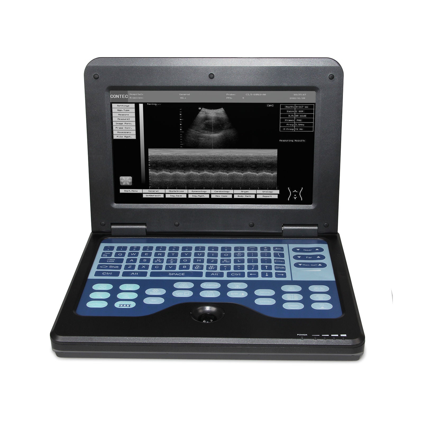 USA Full Digital Portable B-Ultrasoud Scanner 3.5M Convex+7.5M Linear Probe CE  658126923446 DIAGNOSTIC ULTRASOUND MACHINES FOR SALE