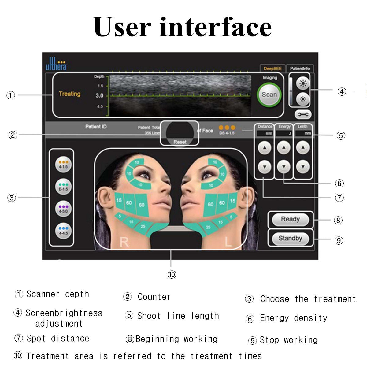 High Intensity Focused Ultrasound HIFU Care Facial Skin  Spa Anti Aging Machine 6930402318325 DIAGNOSTIC ULTRASOUND MACHINES FOR SALE