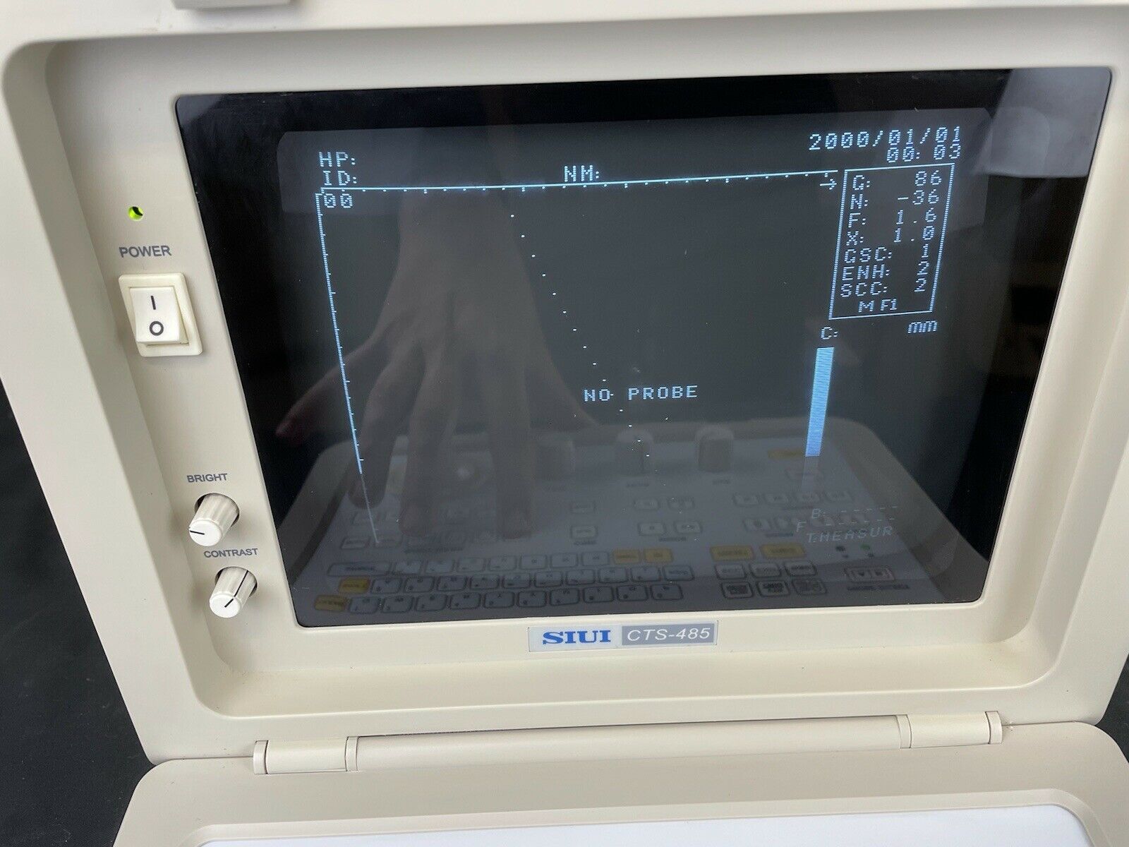 SIUI CTS-485 Ultrasonic Diagnostic Instrument Portable Ultrasound Machine DIAGNOSTIC ULTRASOUND MACHINES FOR SALE