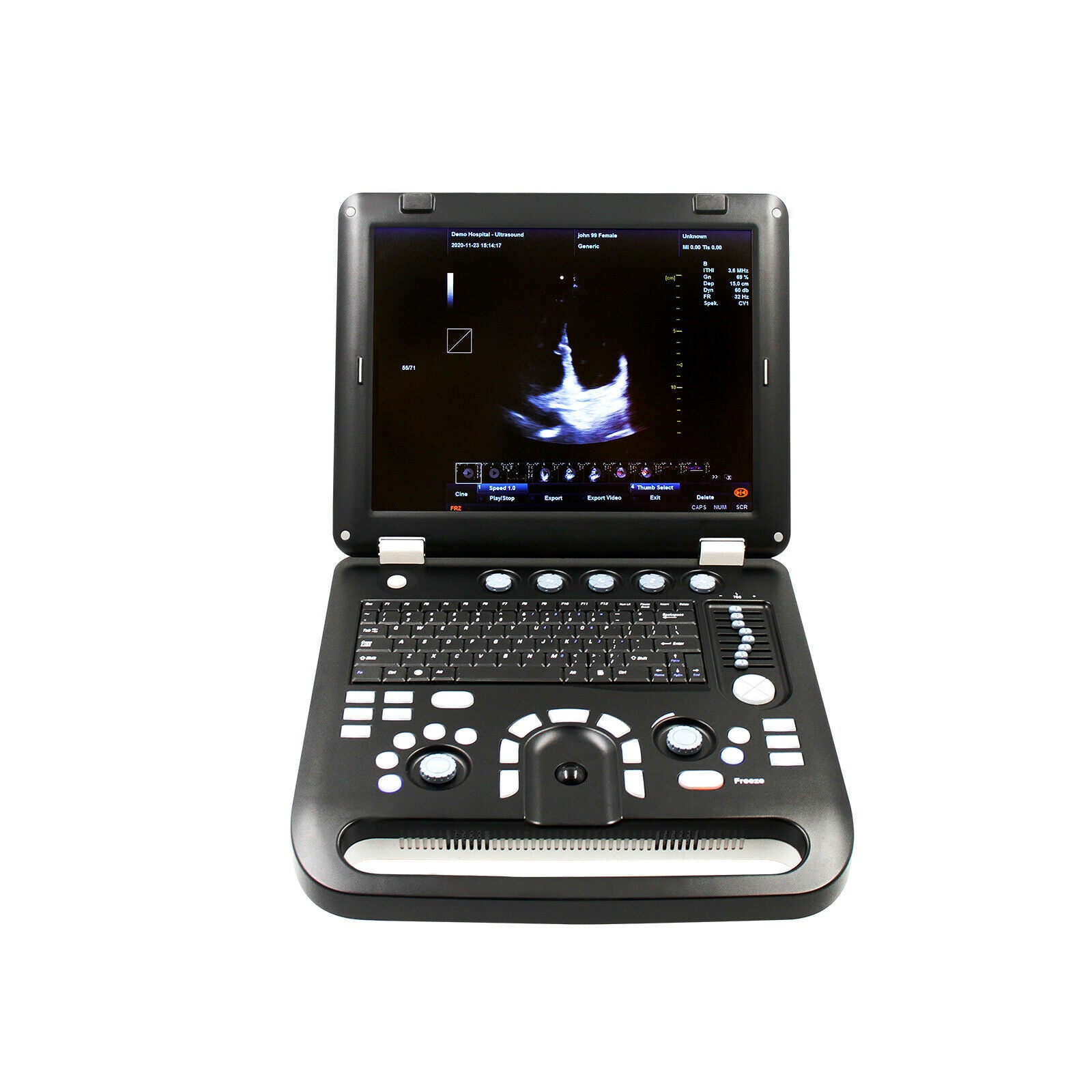 Color Doppler Veterinary Ultrasound Scanner Machine+Rectal Probe PW CW Horse/Cow 670924011996 DIAGNOSTIC ULTRASOUND MACHINES FOR SALE