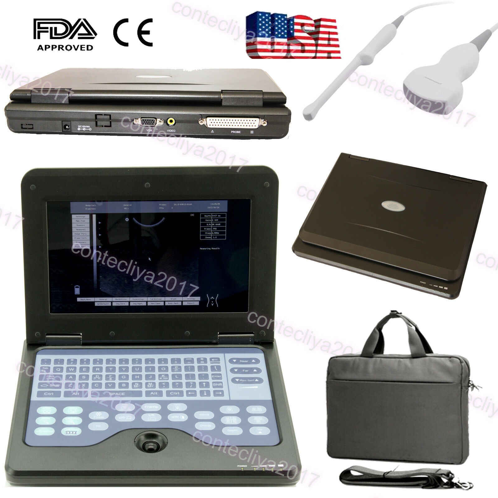 Portable Laptop Ultrasound Machine Digital Diagnostic System,Convex+Transvaginal DIAGNOSTIC ULTRASOUND MACHINES FOR SALE