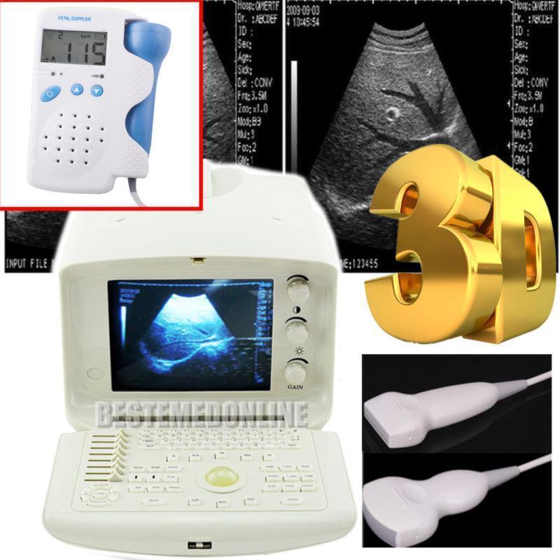 Digital Ultrasound Scanner Machine System Convex  Linear Probe/Transducer 3D DIAGNOSTIC ULTRASOUND MACHINES FOR SALE