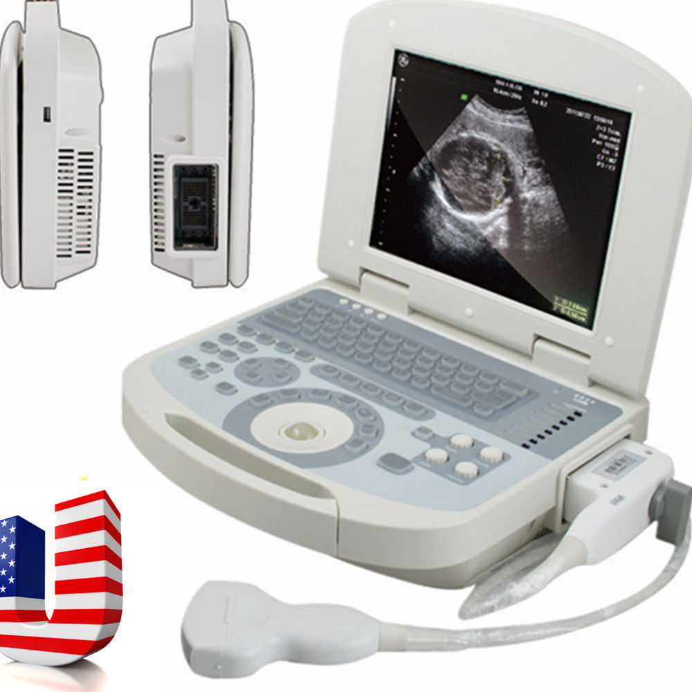 USA Ultrasound Scanner PC Scan Hi-Definition 3D Digital Scanner +Convex Probe 190891402028 DIAGNOSTIC ULTRASOUND MACHINES FOR SALE