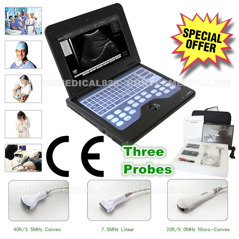 CE Portable Ultrasound Scanner Laptop Machine Diagnostic System Optional 4 Probe DIAGNOSTIC ULTRASOUND MACHINES FOR SALE