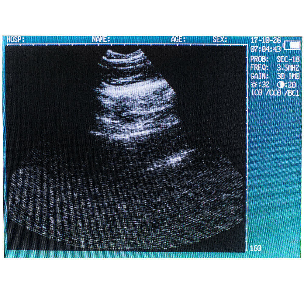 5.5'' Digital Veterinary Ultrasound Scanner Machine for Pregnancy Animal+Probe DIAGNOSTIC ULTRASOUND MACHINES FOR SALE