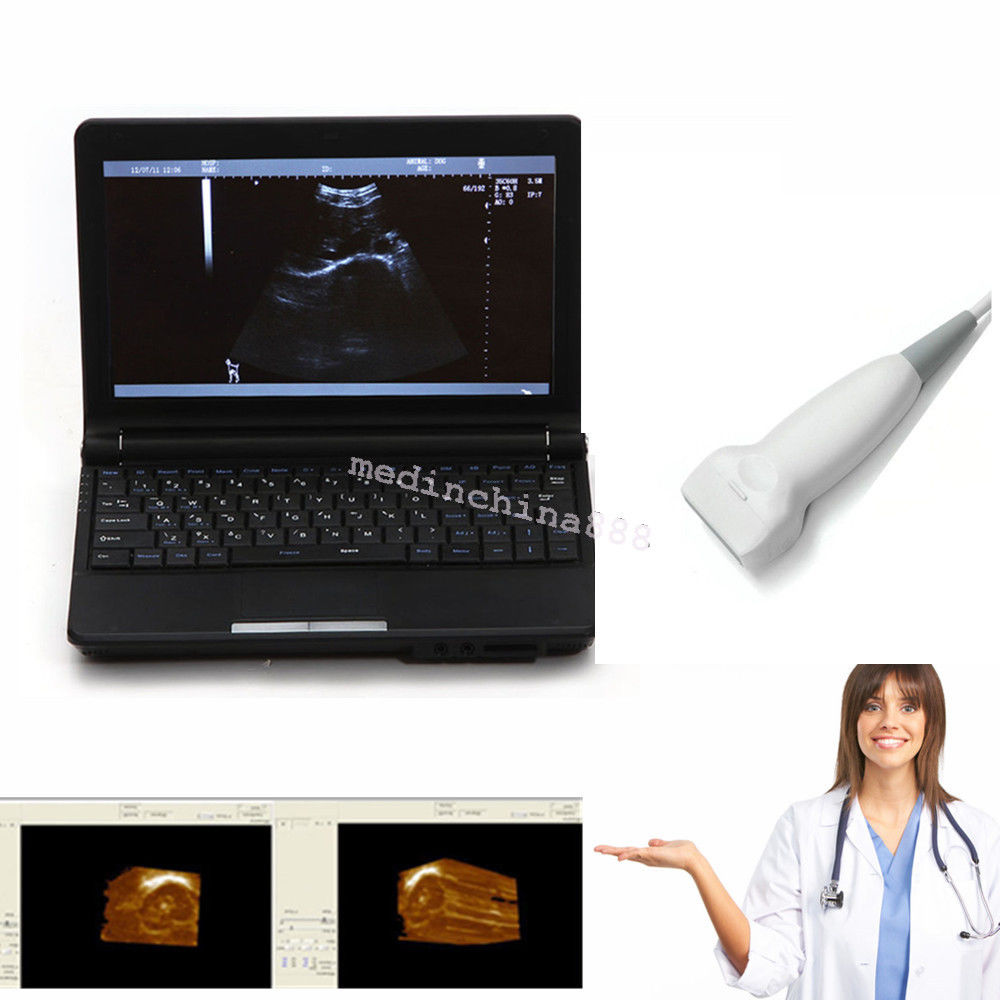 Laptop Ultrasound Scanner/Machine +Vascular Linear Probes Transducer 3D Clear  190891246561 DIAGNOSTIC ULTRASOUND MACHINES FOR SALE