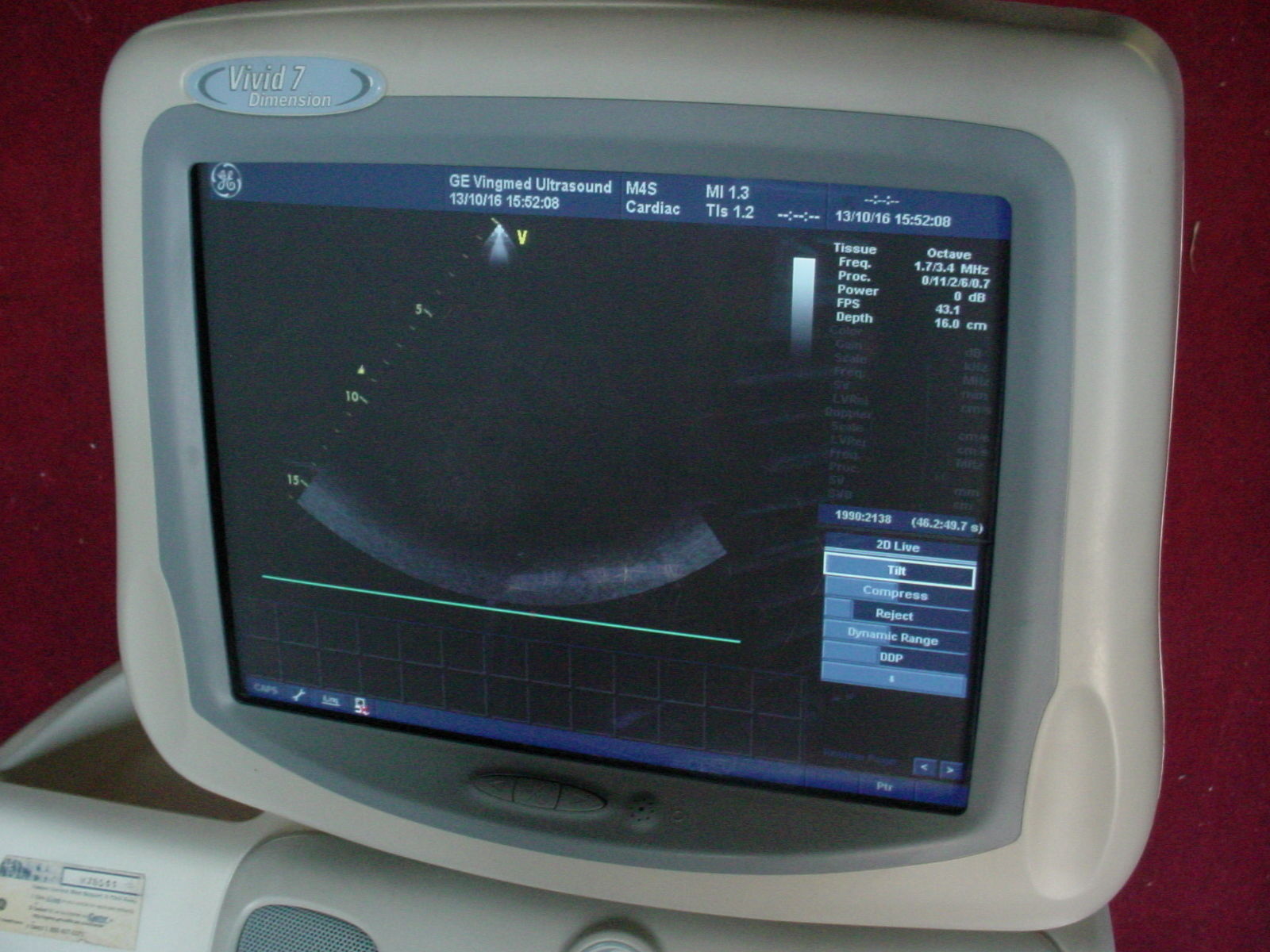 GE Vivid 7 Dimension '06 Ultrasound w/3 Transducer Probes M4S,4C,10S DIAGNOSTIC ULTRASOUND MACHINES FOR SALE