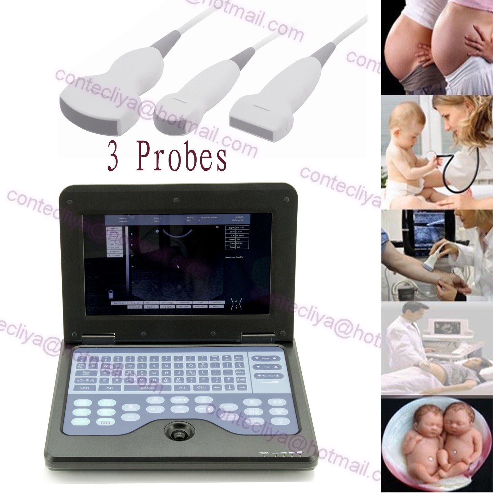 CE Digital Ultrasound Scanner Laptop Machine Diagnostic System Optional 4 Probe DIAGNOSTIC ULTRASOUND MACHINES FOR SALE