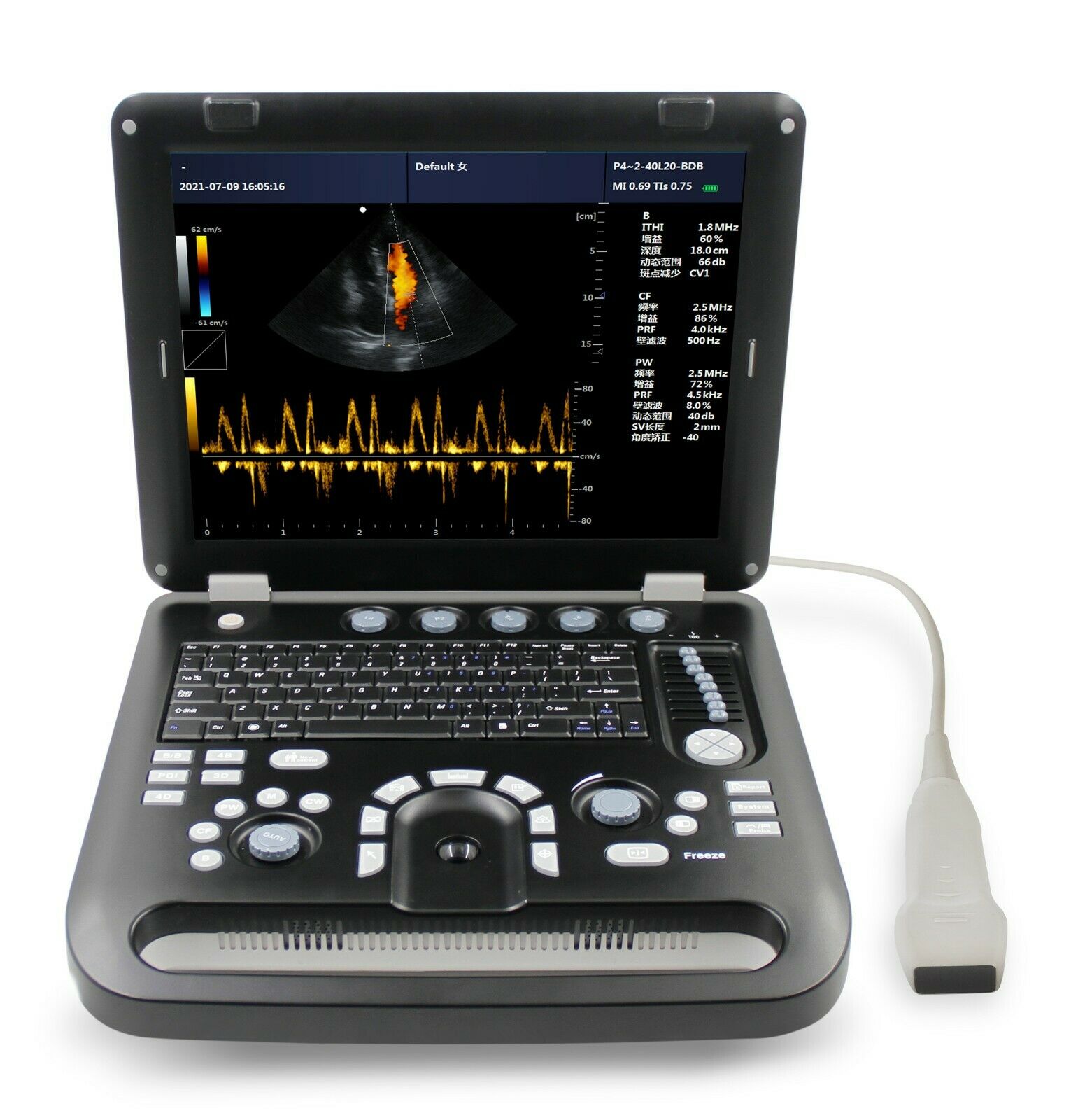 Portable Cardiac Heart Ultrasound Scanner Color Doppler Machine Phased Array PW DIAGNOSTIC ULTRASOUND MACHINES FOR SALE