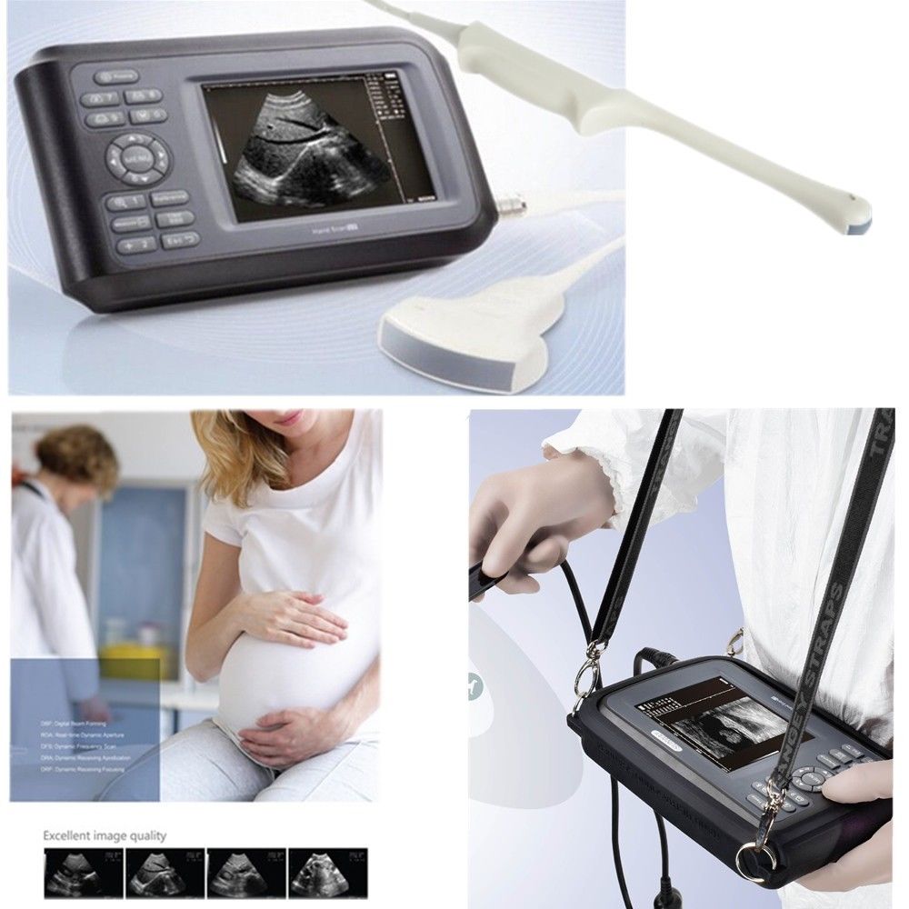 Laptop Machine HandScan Ultrasound scanner Convex + Linear+ Micro Convex Probe DIAGNOSTIC ULTRASOUND MACHINES FOR SALE