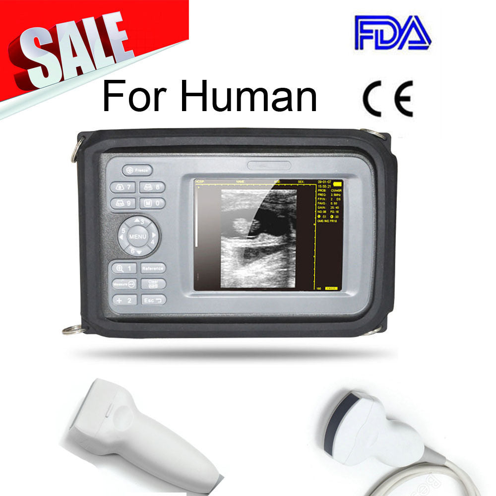 5.5 " Palm Ultrasound Machine Scanner Convex & Linear 2 Probes Human Free Box AA 190891421289 DIAGNOSTIC ULTRASOUND MACHINES FOR SALE