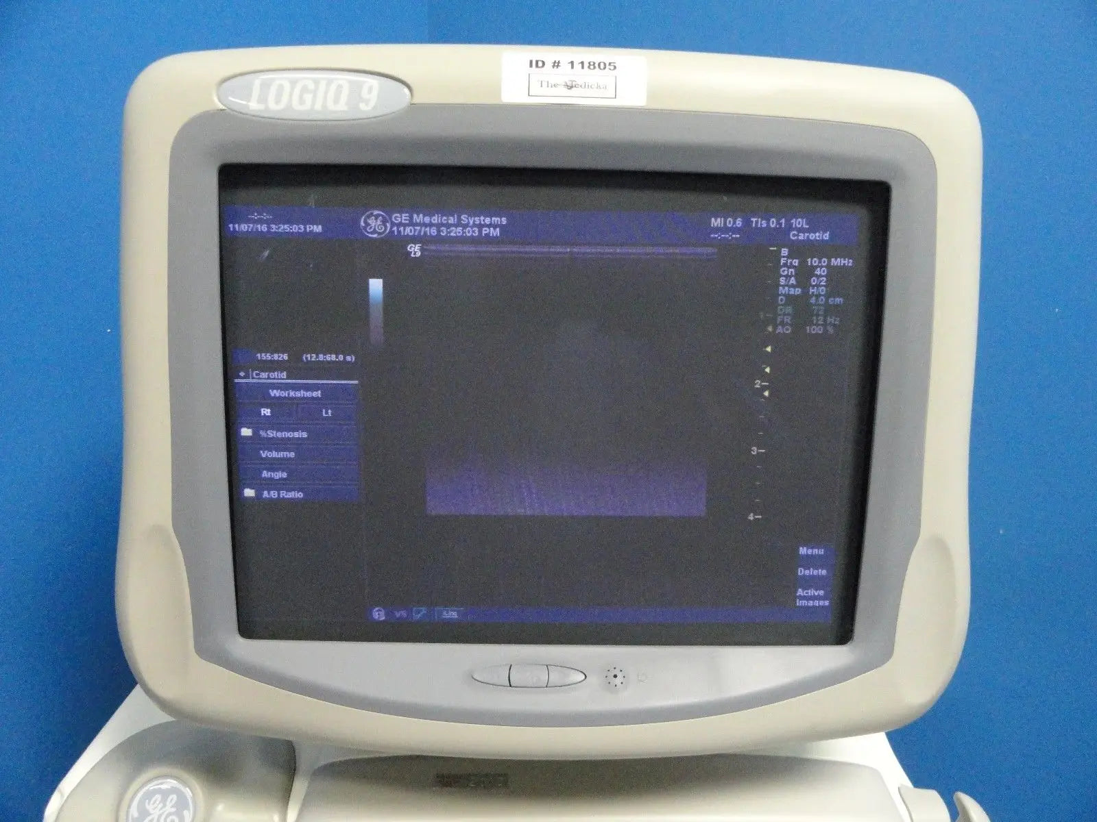 2003 GE LOGIQ 9 Ultrasound W/ Sony UP-895MD & Sony UP-D50 Printers (7255) DIAGNOSTIC ULTRASOUND MACHINES FOR SALE