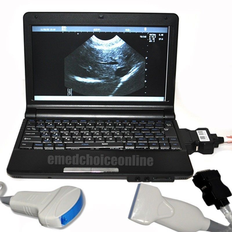 Full Digital Laptop Ultrasound Scanner 2 Probes Covex + Linear Probes 3D Photo A 190891802569 DIAGNOSTIC ULTRASOUND MACHINES FOR SALE