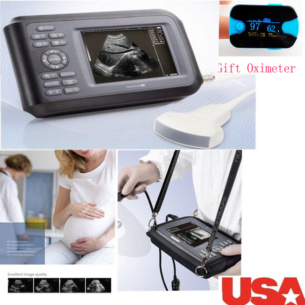 USA! Medical Ultrasound Scanner Machine Convex Probe Abdominal Scan + Oximeter 190891827272 DIAGNOSTIC ULTRASOUND MACHINES FOR SALE