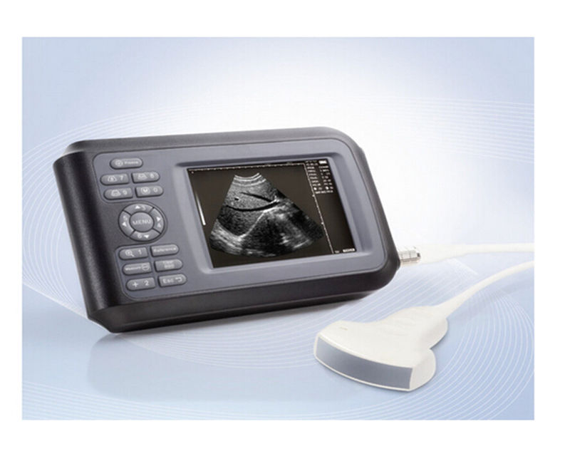 5.5 inch Ultrasound Machine Scanner 3.5 Mhz Convex +7.5Mhz Linear Probe   Human DIAGNOSTIC ULTRASOUND MACHINES FOR SALE