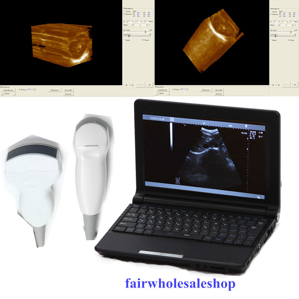 Laptop Ultrasound Scanner/Machine/System convex+micro-convex Heart +3D 2 probes 190891457554 DIAGNOSTIC ULTRASOUND MACHINES FOR SALE