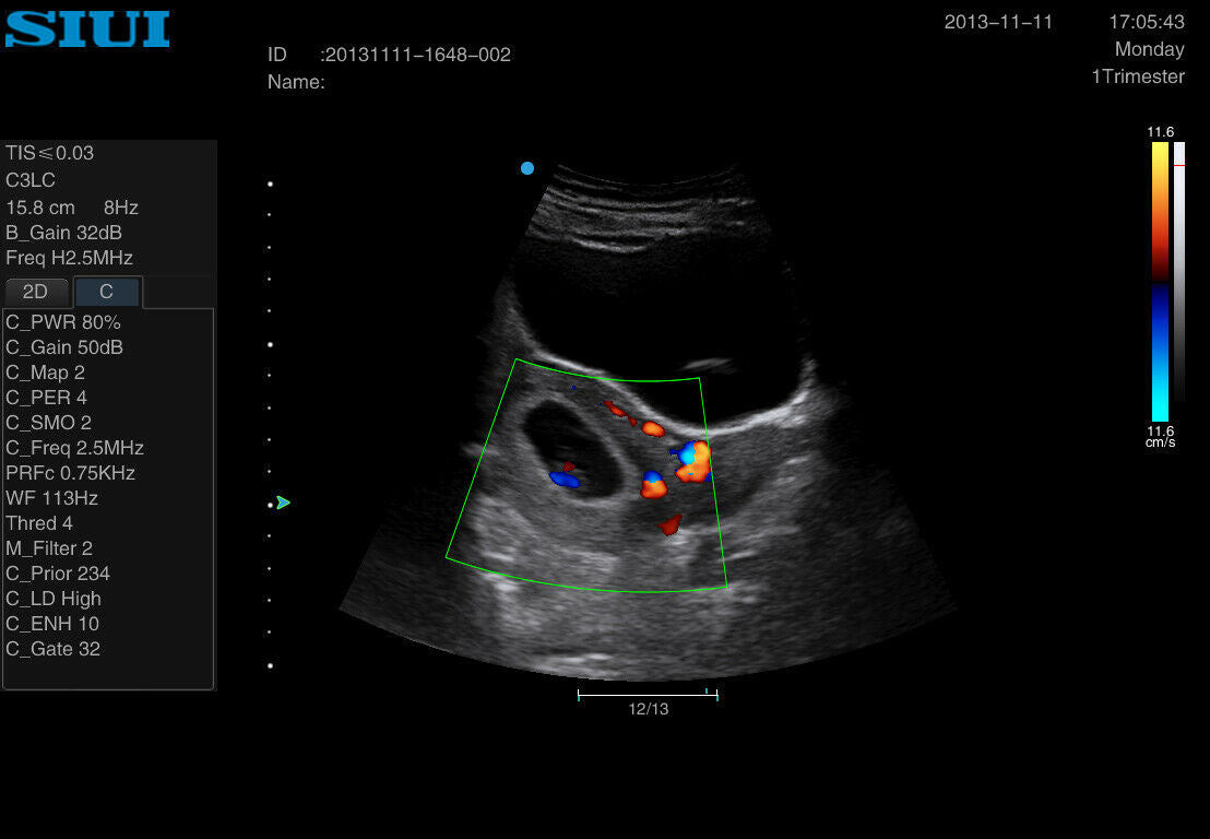 Portable OB/GYN Ultrasound Machine SIUI Apogee 2300 w/2 Probes (DICOM) (NEW) DIAGNOSTIC ULTRASOUND MACHINES FOR SALE