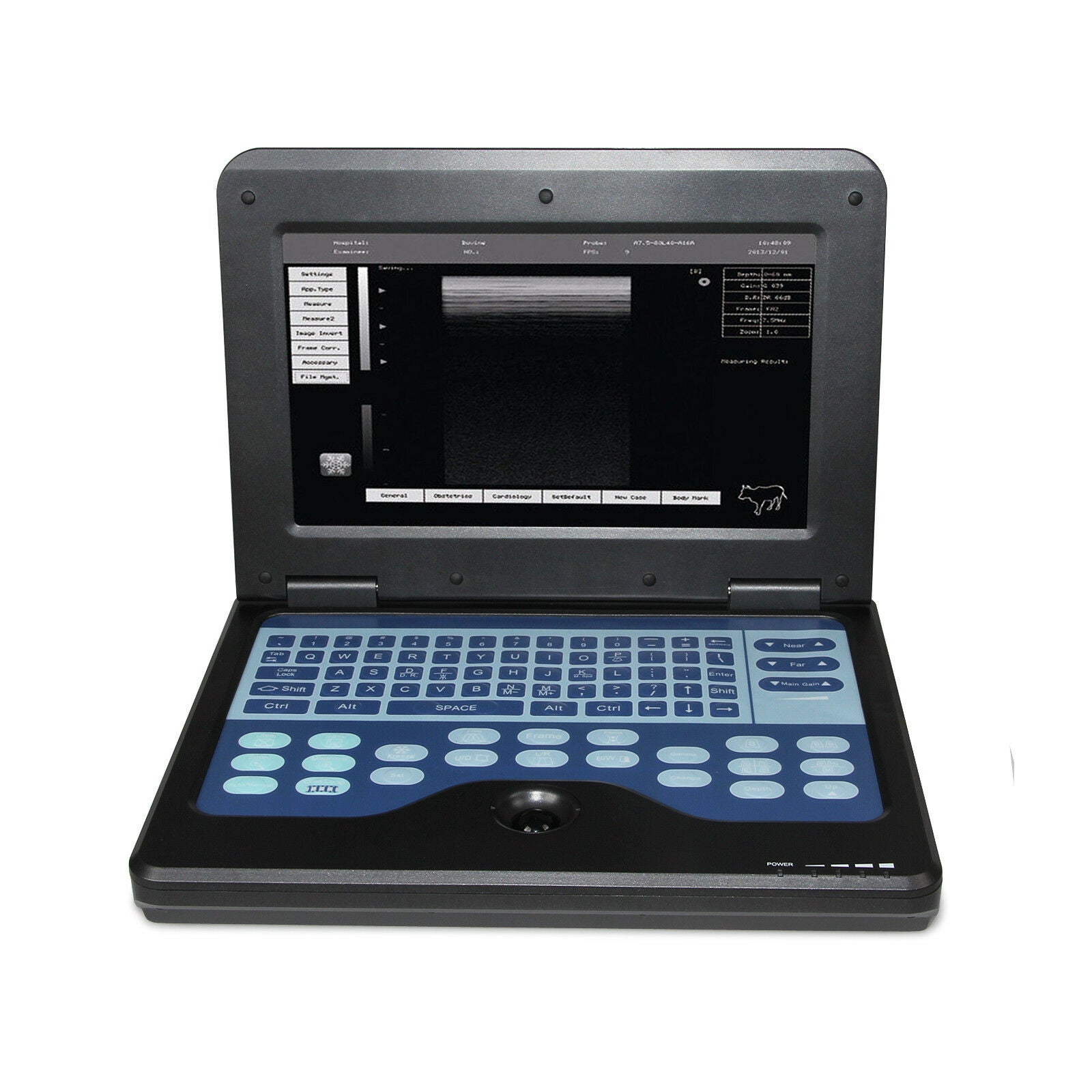 Ultrasound Scanner Laptop Digital Abdominal Diagnostic Machine 3.5 Convex USA 658126883672 DIAGNOSTIC ULTRASOUND MACHINES FOR SALE