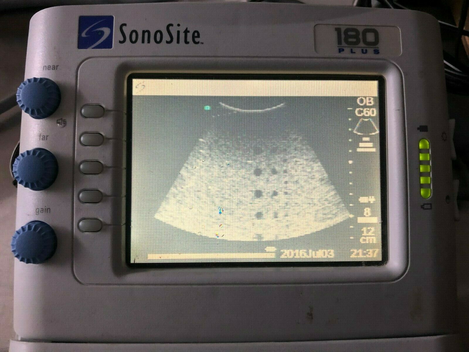 SonoSite 180 Plus Portable Ultrasound System With C60/5-2 Probe DIAGNOSTIC ULTRASOUND MACHINES FOR SALE