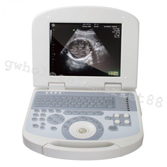 US Notebook Ultrasound Machine Scanner System Convex Probe +3D Software Portable 190891422491 DIAGNOSTIC ULTRASOUND MACHINES FOR SALE