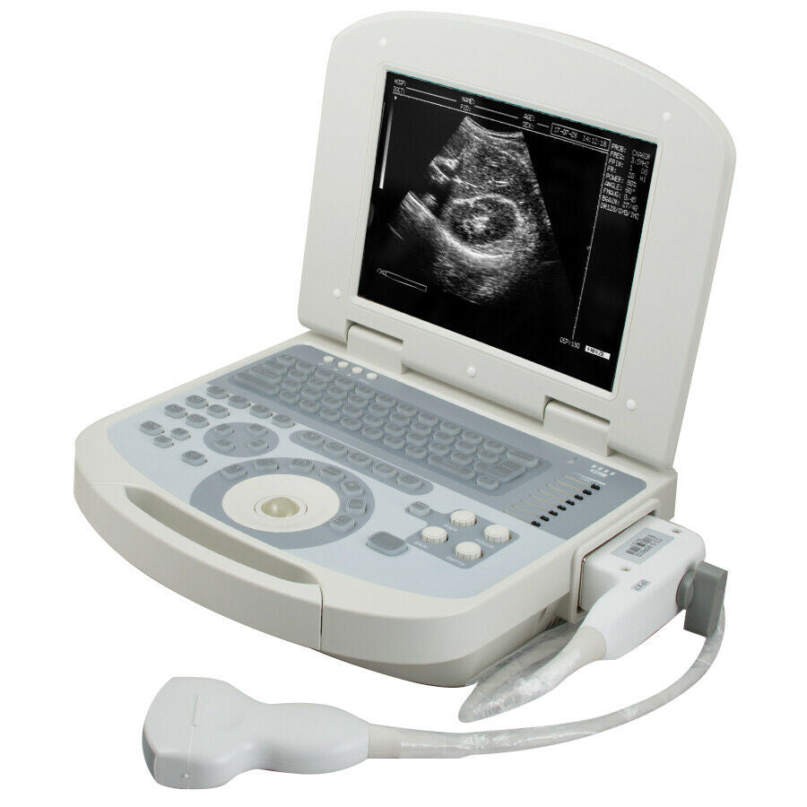 USA 10.4 inch Digital Laptop Medical Ultrasound Scanner 3.5MHZ Convex Probe USA DIAGNOSTIC ULTRASOUND MACHINES FOR SALE