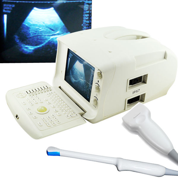 Portable Digital Ultrasound Scanner Machine With Linear+Transvaginal Probe,+3D 190891052506 DIAGNOSTIC ULTRASOUND MACHINES FOR SALE