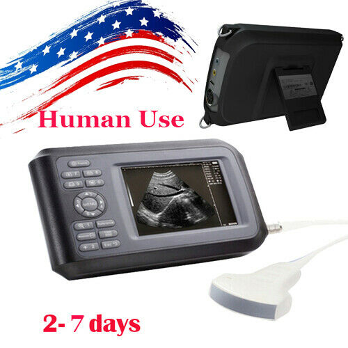 Portable Digital Ultrasound Scanner Machine Diagnostic System Cardiac 3.5 Convex DIAGNOSTIC ULTRASOUND MACHINES FOR SALE