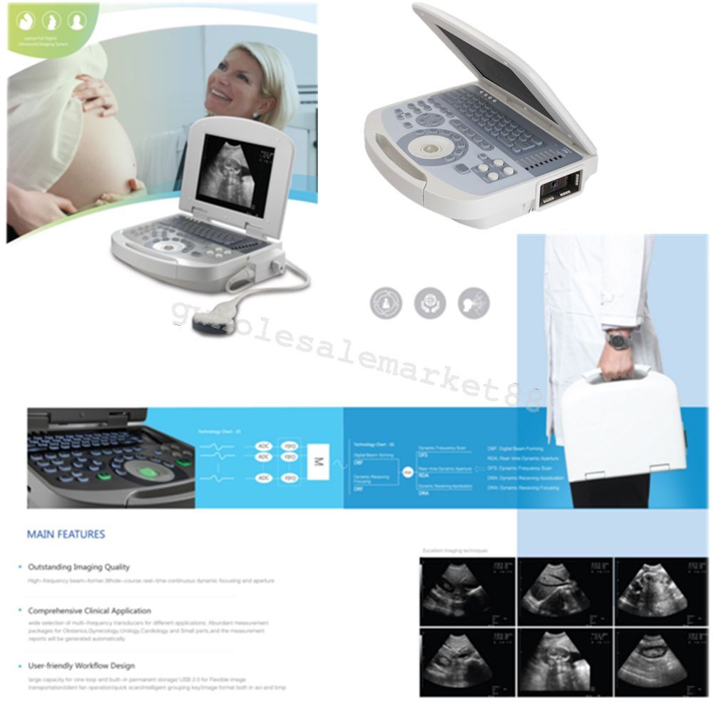 USA Digital Medical Ultrasound Machine Scanner Convex probe 3D Image Pregnancy 190891393838 DIAGNOSTIC ULTRASOUND MACHINES FOR SALE