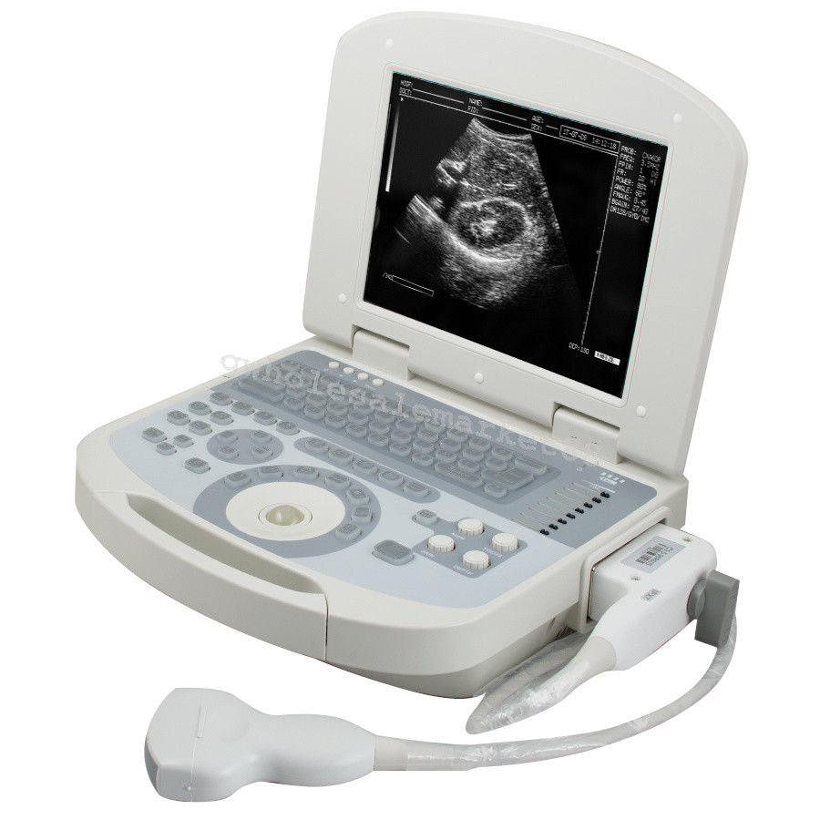 US Hot Portable Ultrasound Machine Scanner System Convex probe 3D Software Image 190891045898 DIAGNOSTIC ULTRASOUND MACHINES FOR SALE