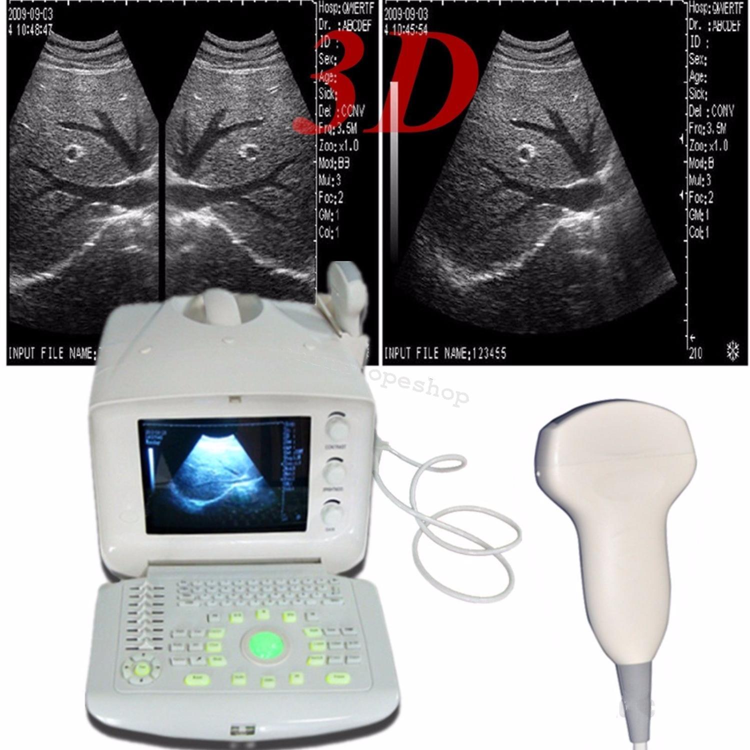 New 3D Digital Portable Ultrasound Scanner machine & Convex & Linear 2 Probe A+ 190891667847 DIAGNOSTIC ULTRASOUND MACHINES FOR SALE