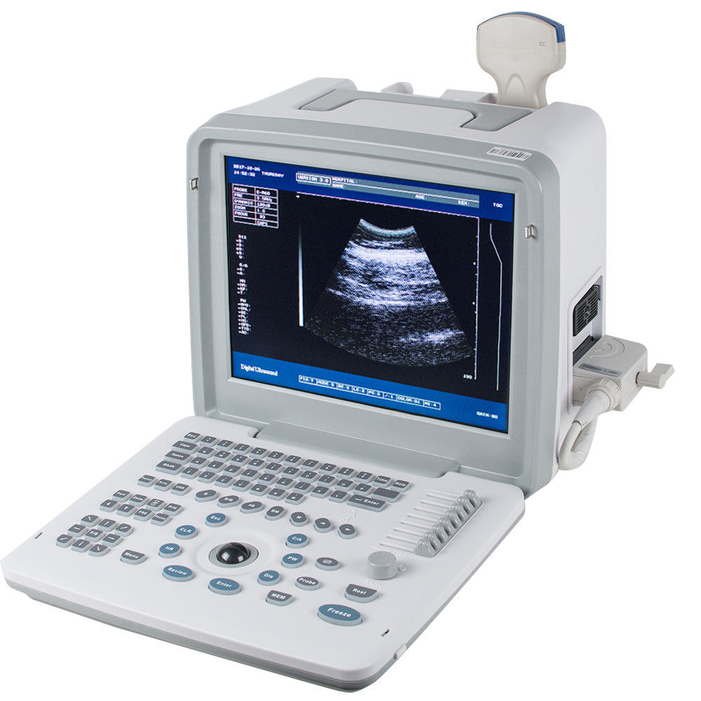 Full Digital Portable Ultrasound Scanner Machine Convex Probe 12inch LCD monitor DIAGNOSTIC ULTRASOUND MACHINES FOR SALE