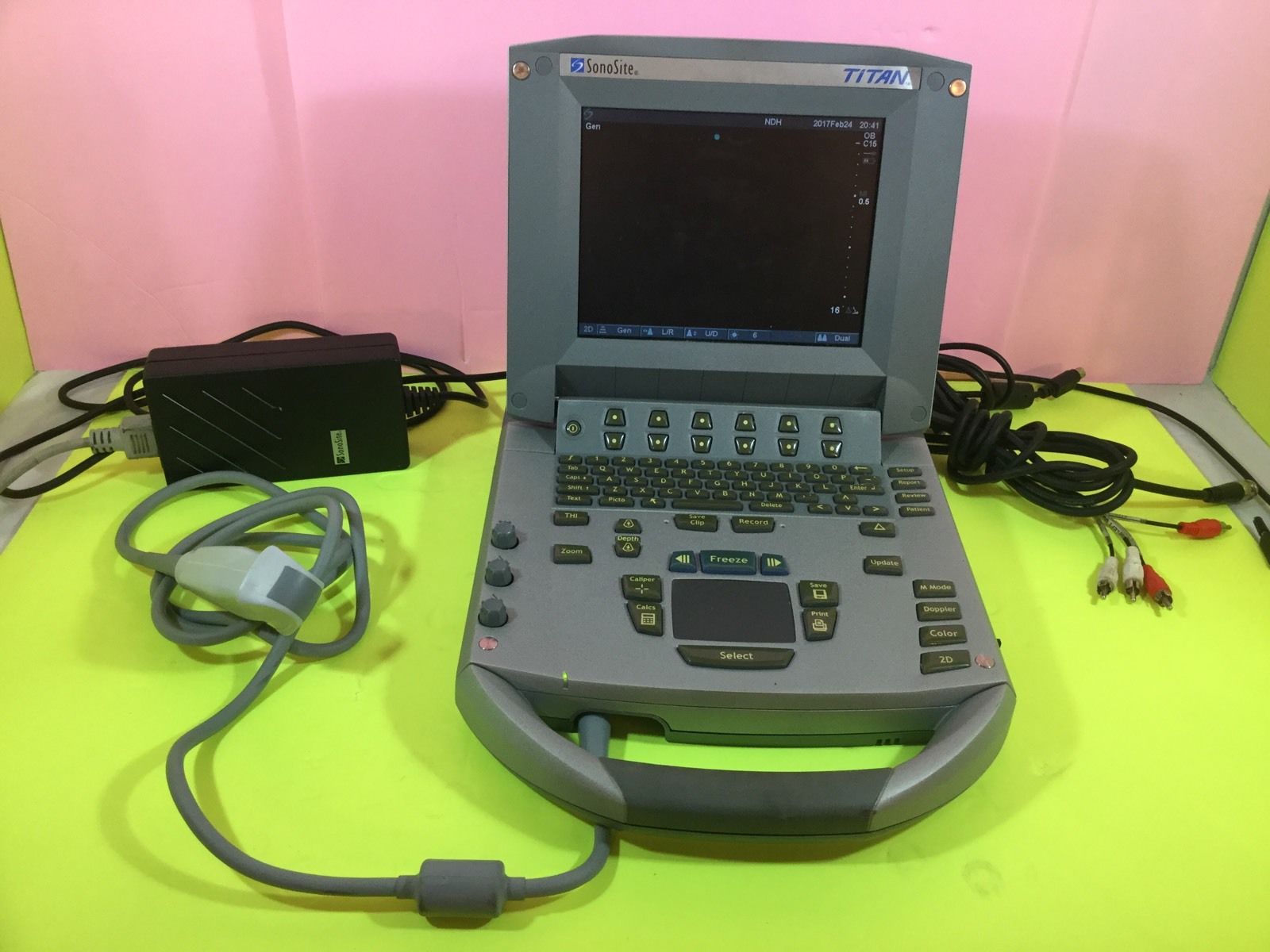 SONOSITE TITAN Portable Ultrasound with C15/4-2 and L38/10-5 Transducers DIAGNOSTIC ULTRASOUND MACHINES FOR SALE