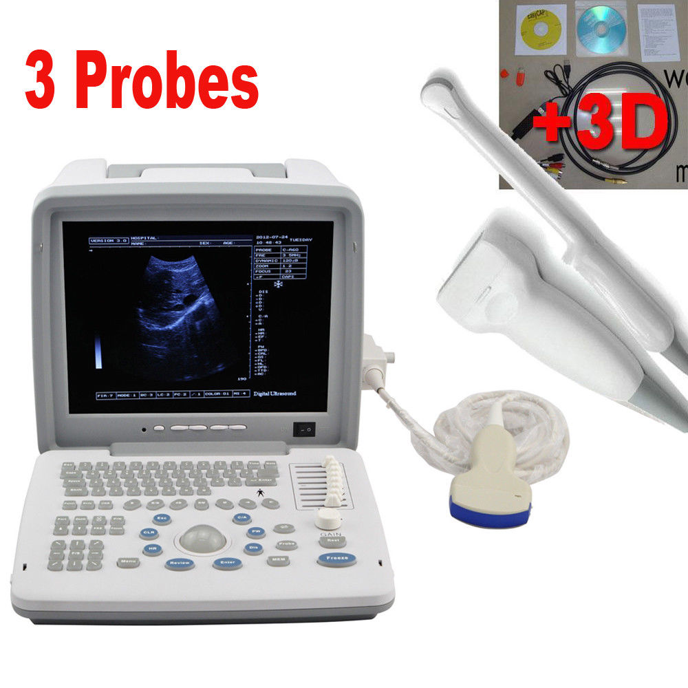 Digital Ultrasound Scanner Machine Convex/Linear/Transvaginal 3 Probes UPS DIAGNOSTIC ULTRASOUND MACHINES FOR SALE