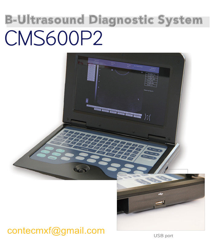 CE Portable Ultrasound Scanner Laptop Machine Diagnostic System Optional 4 Probe DIAGNOSTIC ULTRASOUND MACHINES FOR SALE