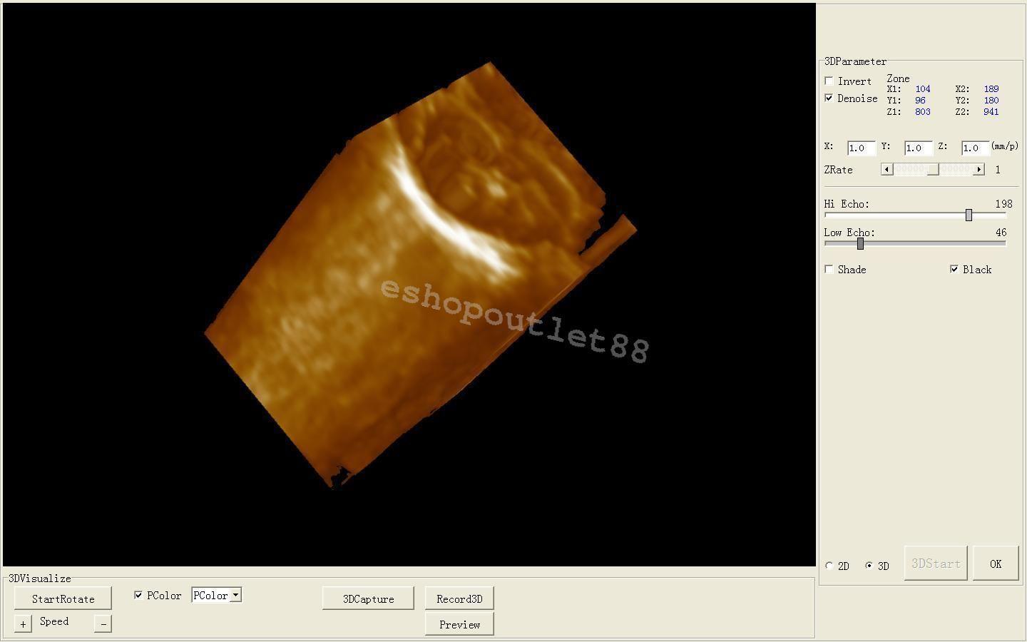 CE Full Digital Laptop Ultrasound Scanner with Linear probe +Free 3D 9000F Model DIAGNOSTIC ULTRASOUND MACHINES FOR SALE