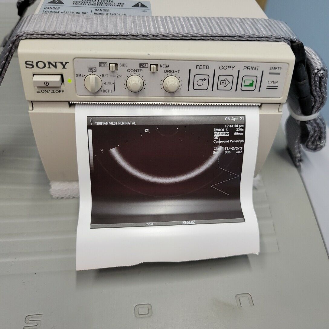 Siemens Sequoia 512 Ultrasound System with 3 probes DIAGNOSTIC ULTRASOUND MACHINES FOR SALE