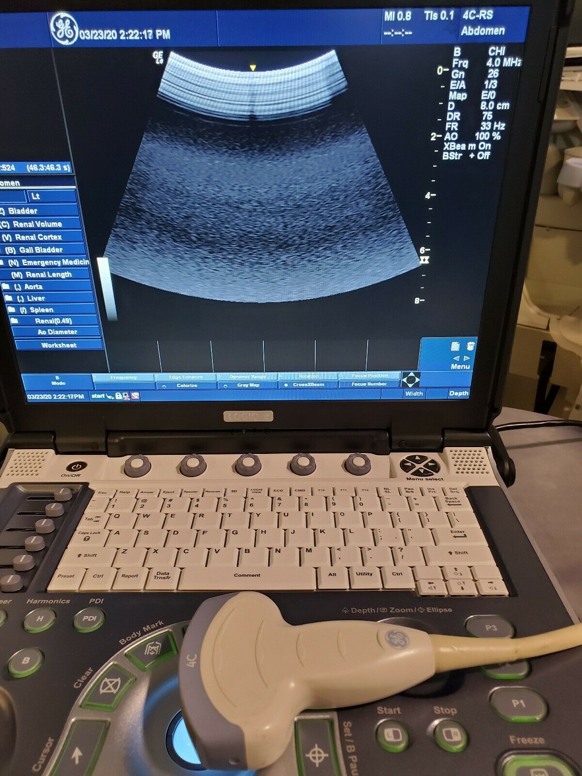 GE LOGIQ E BT12 PORTABLE ULTRASOUND W/2 PROBES E8C-RS 4C-RS DIAGNOSTIC ULTRASOUND MACHINES FOR SALE